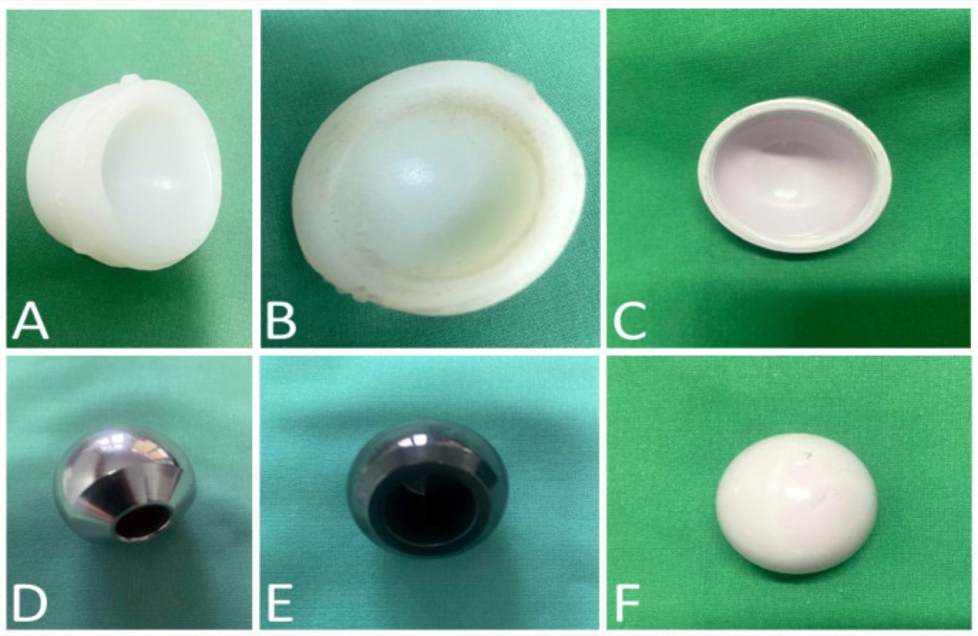 Figure 2. Bearing components: (A) cross-linked and (B) conventional polyethylene liners, (C) ceramic liner, (D) cobalt-chrome head, (E) oxidised-zirconium head, (F) ceramic head. From Savin et al. (2023), Polymers 15:3278, PMC10422432, Fig. 2, CC BY 4.0.