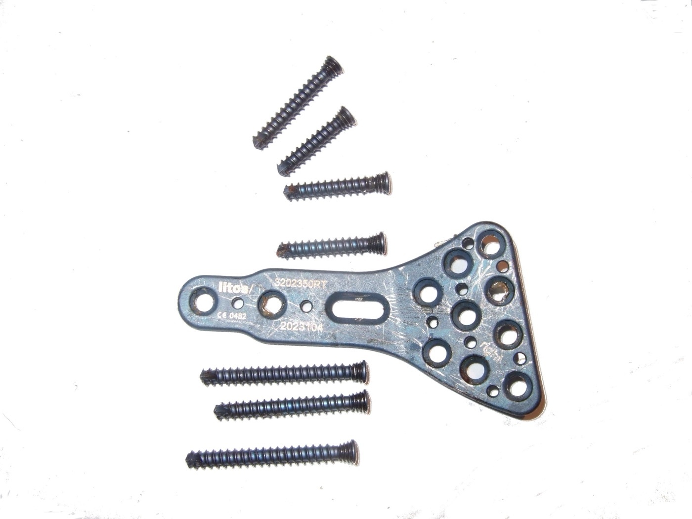 Figure 13. A distal radius (anatomic locking) plate and screws, the implant used for volar fixation. Codc, via Wikimedia Commons, CC BY-SA 4.0.