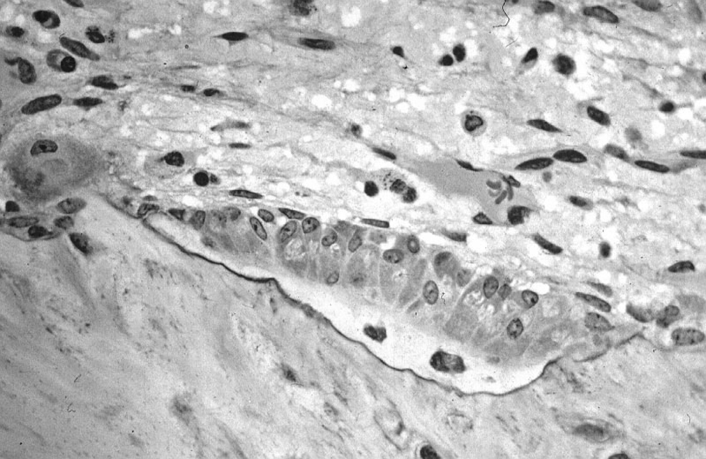 Figure 7. Active osteoblasts lining bone and forming osteoid, with embedded osteocytes. Source: Robert M. Hunt, via Wikimedia Commons, CC BY-SA 3.0.