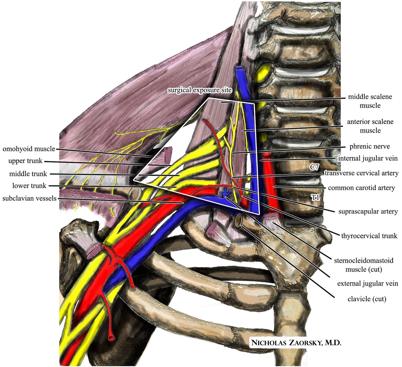 Figure 11. Neurovascular anatomy of the thoracic outlet: the brachial plexus and subclavian artery pass between the anterior and middle scalenes over the first rib. Source: Nicholas Zaorsky MD, via Wikimedia Commons, CC BY-SA 3.0.