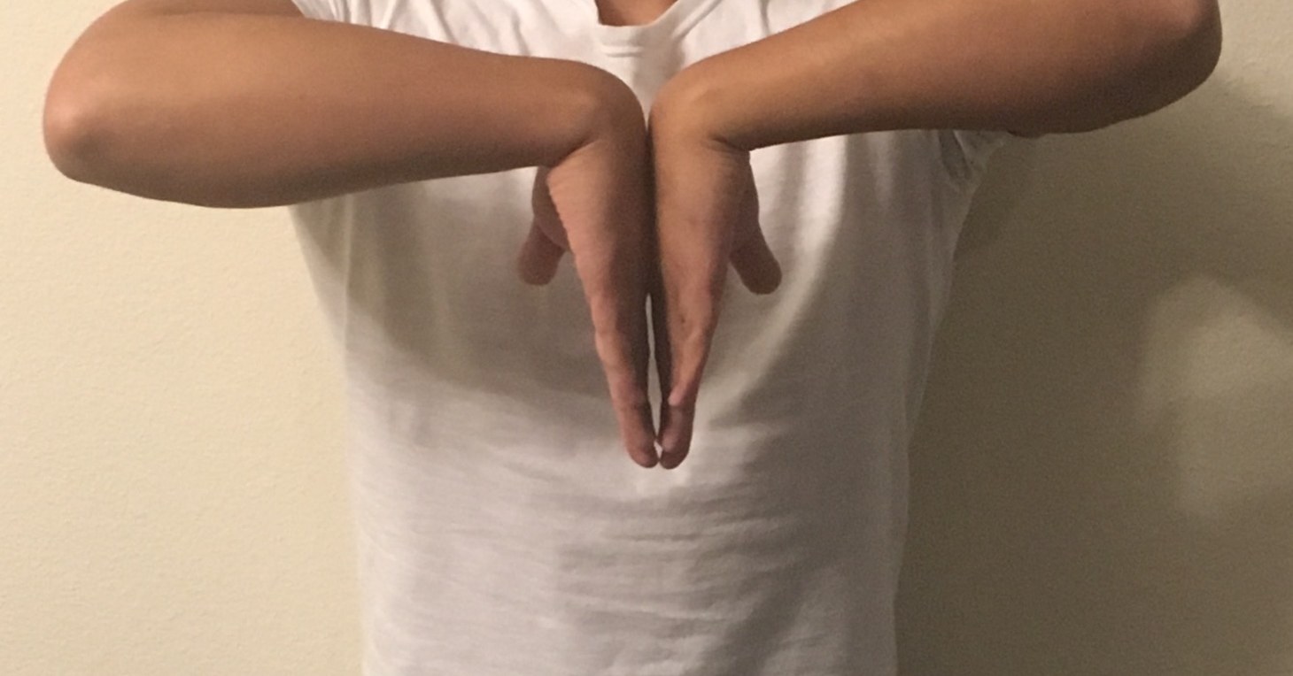 Figure 3. Phalen’s manoeuvre: sustained wrist flexion reproduces median paraesthesiae in carpal tunnel syndrome. Source: LittleT889, via Wikimedia Commons, CC BY-SA 4.0 (cropped).