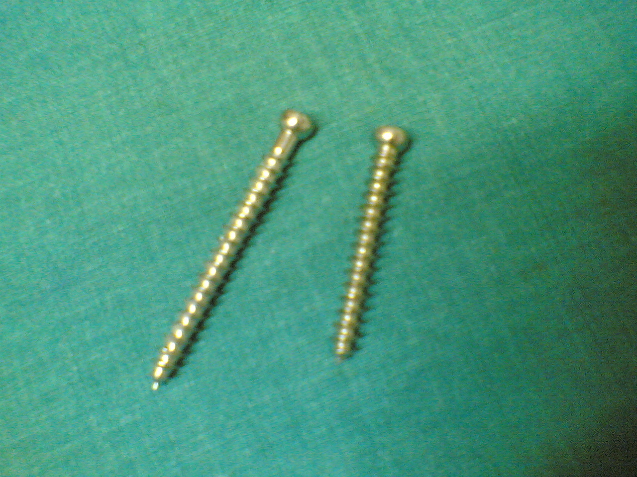 Figure 3. Cancellous bone screws, with a larger pitch and deeper thread for purchase in metaphyseal bone. Source: Netha Hussain, via Wikimedia Commons, CC BY-SA 3.0.