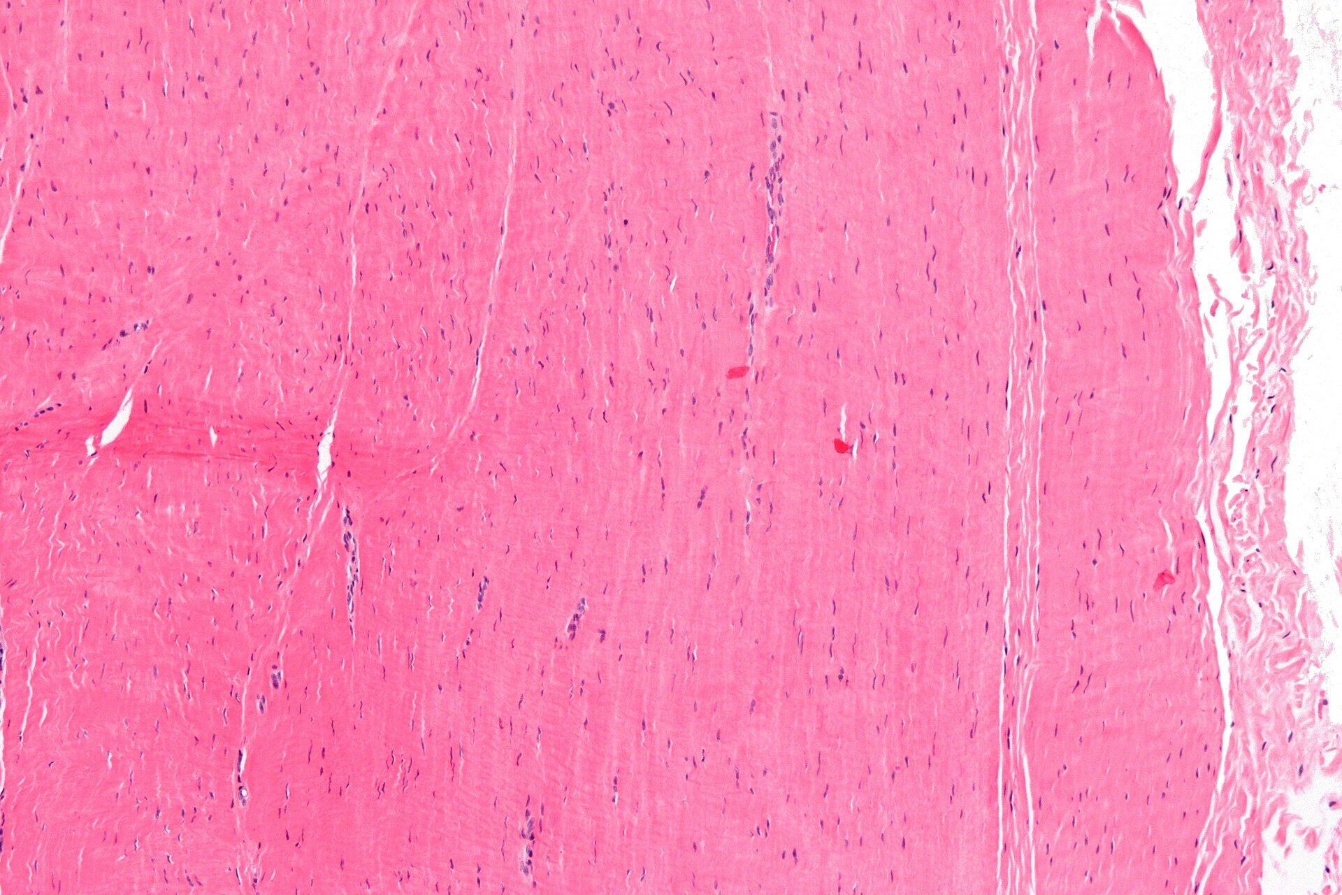 Figure 2. Normal tendon histology (H\&E): dense parallel collagen bundles with sparse interspersed tenocyte nuclei. Source: Nephron, via Wikimedia Commons, CC BY-SA 3.0.