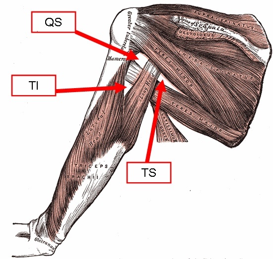 Figure 10. The quadrangular space (QS), triangular space (TS) and triangular interval (TI) of the posterior shoulder, defined by teres minor, teres major and the triceps; straying below teres minor enters the quadrangular space. Gray’s Anatomy (1918), annotated, public domain, via Wikimedia Commons.
