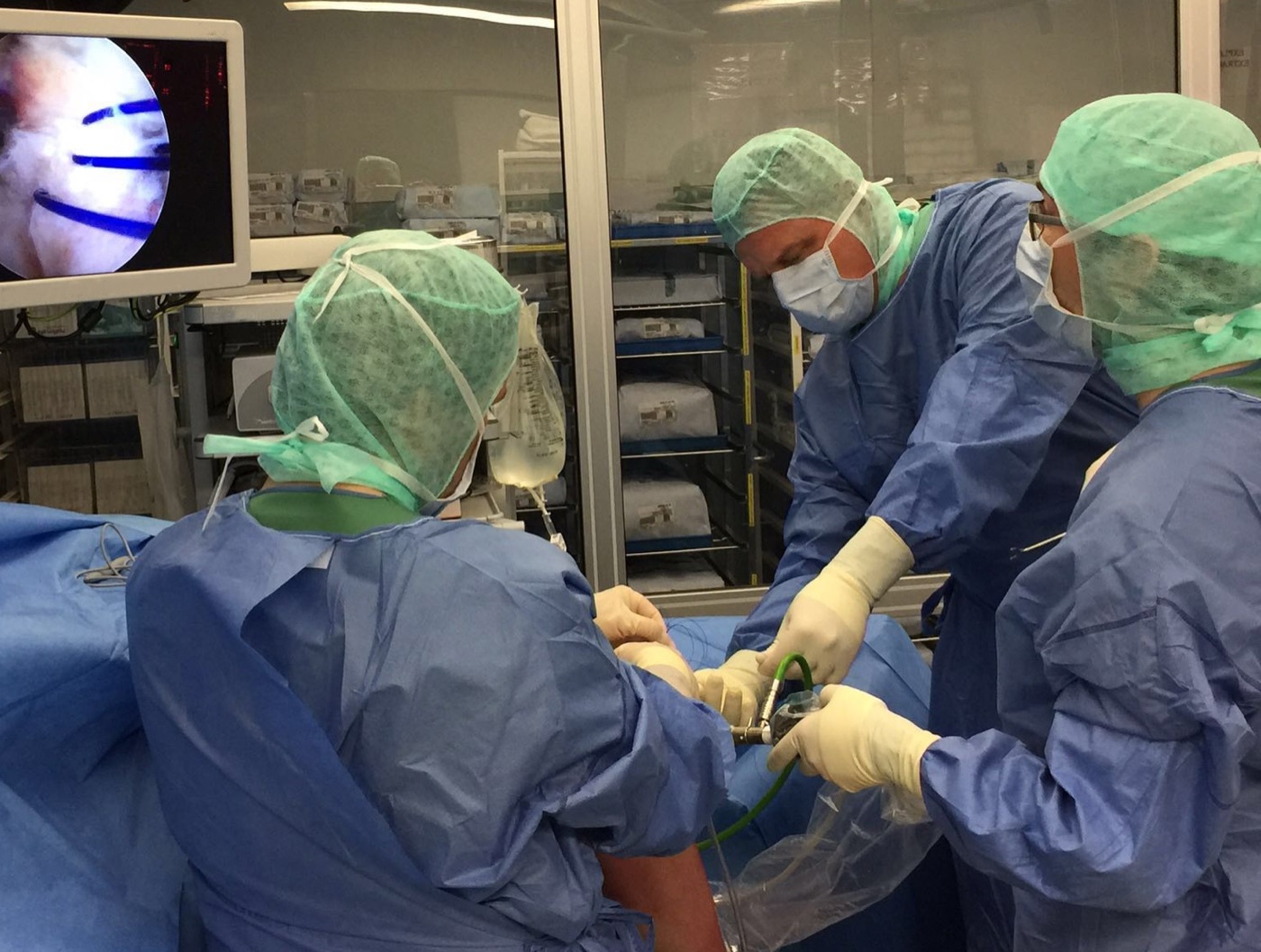 Figure 16. Knee arthroscopy in progress: the arthroscope and instruments inserted through the anterior portals, with the intra-articular image displayed on the tower monitor. Ligamentaxis, CC BY-SA 4.0, via Wikimedia Commons.